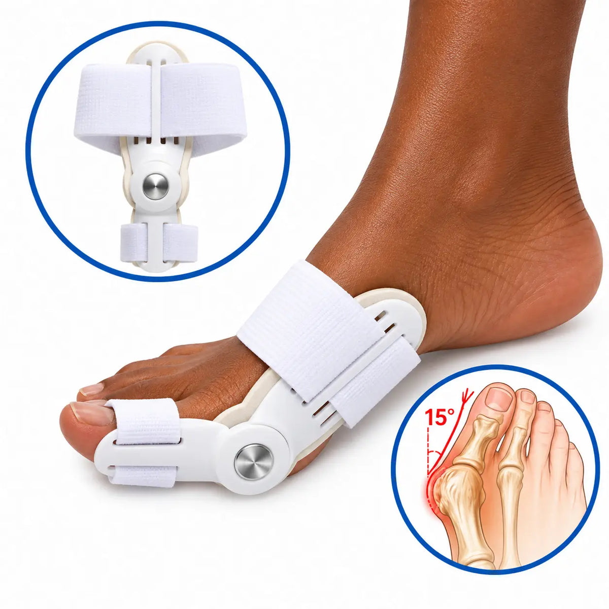Orthèses correctrices pour hallux valgus - Soulagez la pression et l’inconfort du gros orteil